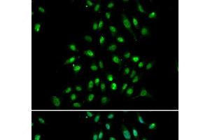 Immunofluorescence analysis of A549 cells using CXXC1 Polyclonal Antibody (CXXC1 anticorps)