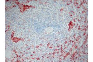 Image no. 1 for anti-Ionized Calcium-binding Adapter Molecule 1 (IBA1) antibody (ABIN379966) (Iba1 anticorps)