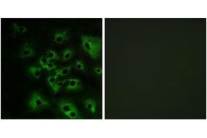 Immunofluorescence analysis of HeLa cells treated with EGF 200nM 5', using HER4 (Phospho-Tyr1284) Antibody. (ERBB4 anticorps  (pTyr1284))