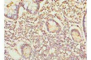 Immunohistochemistry of paraffin-embedded human small intestine tissue using ABIN7156305 at dilution of 1:100