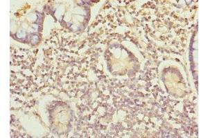 Immunohistochemistry of paraffin-embedded human small intestine tissue using ABIN7156305 at dilution of 1:100 (IP6K2 anticorps  (AA 1-180))