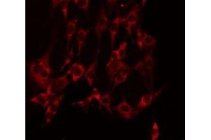 ABIN6275112 staining NIH-3T3 by IF/ICC. (EPH Receptor A10 anticorps  (Internal Region))