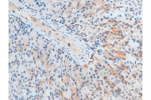 ABIN6267250 at 1/100 staining mouse gastric tissue sections by IHC-P.