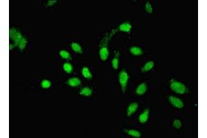 Immunofluorescent analysis of Hela cells using ABIN7163042 at dilution of 1:100 and Alexa Fluor 488-congugated AffiniPure Goat Anti-Rabbit IgG(H+L) (PHF1 anticorps  (AA 151-360))