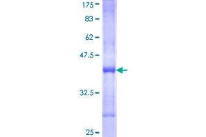Image no. 1 for Nik Related Kinase (NRK) (AA 1483-1582) protein (GST tag) (ABIN1313035)