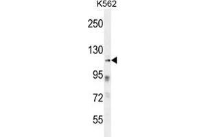 ZNF99 Antibody (N-term) western blot analysis in K562 cell line lysates (35 µg/lane). (ZNF99 anticorps  (N-Term))