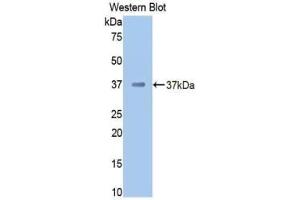 Western blot analysis of the recombinant protein. (Prothrombin anticorps  (AA 325-618))