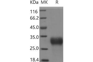 Western Blotting (WB) image for Insulin-Like Growth Factor Binding Protein 6 (IGFBP6) protein (His tag) (ABIN7321054)