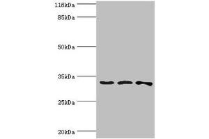 Western blot All lanes: STARD10 antibody at 2 μg/mL Lane 1: 293T whole cell lysate Lane 2: k562 whole cell lysate Lane 3: Mouse heart tissue Secondary Goat polyclonal to rabbit IgG at 1/10000 dilution Predicted band size: 33 kDa Observed band size: 33 kDa (STAR anticorps  (AA 1-291))