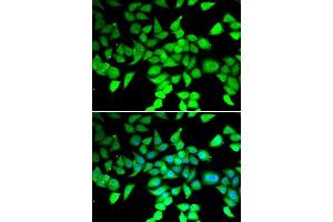 Immunofluorescence analysis of MCF-7 cells using HDAC7 antibody. (HDAC7 anticorps  (AA 400-500))