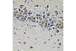 Immunohistochemistry of paraffin-embedded mouse brain using PLCG1 Antibody. (Phospholipase C gamma 1 anticorps)