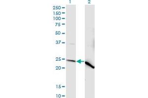 Western Blot analysis of NDUFV2 expression in transfected 293T cell line by NDUFV2 monoclonal antibody (M03), clone 1A10.