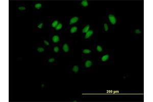 Immunofluorescence of purified MaxPab antibody to MXD3 on HeLa cell. (MXD3 anticorps  (AA 1-206))