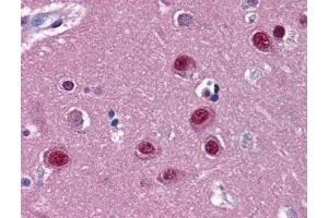 Immunohistochemistry (IHC) image for anti-Nuclear Receptor Subfamily 1, Group D, Member 1 (NR1D1) (AA 1-615) antibody (ABIN614695)