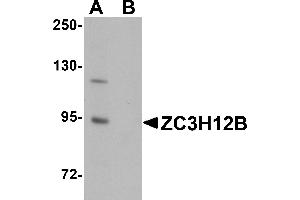 Western Blotting (WB) image for anti-Zinc Finger CCCH-Type Containing 12B (ZC3H12B) (N-Term) antibody (ABIN1031673) (ZC3H12B anticorps  (N-Term))