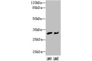 Western blot All lanes: NIT2 antibody at 3 μg/mL Lane 1: Mouse heart tissue Lane 2: A549 whole cell lysate Secondary Goat polyclonal to rabbit IgG at 1/10000 dilution Predicted band size: 31 kDa Observed band size: 31 kDa (NIT2 anticorps  (AA 1-276))