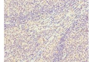 Immunohistochemistry of paraffin-embedded human tonsil tissue using ABIN7170368 at dilution of 1:100 (SNX18 anticorps  (AA 449-628))