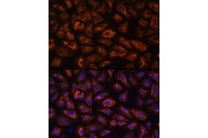 Immunofluorescence analysis of U-2 OS cells using VEGFR3/FLT4 Rabbit pAb (ABIN6130780, ABIN6140699, ABIN6140702 and ABIN6221242) at dilution of 1:100 (40x lens).