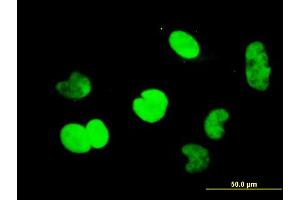 Immunofluorescence of monoclonal antibody to CTBP1 on HeLa cell. (CTBP1 anticorps  (AA 1-429))