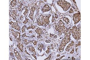 IHC analysis of RCC1 using anti-RCC1 antibody (ABIN7600022). (RCC1 anticorps  (AA 14-421))