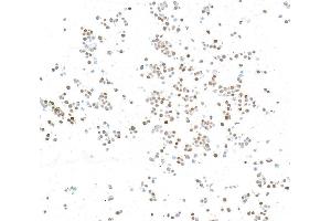 Immunocytochemistry (ICC) image for anti-N-Myc Proto-Oncogene Protein (MYCN) (AA 100-150) antibody (ABIN7795786) (Recombinant MYCN anticorps  (AA 100-150))