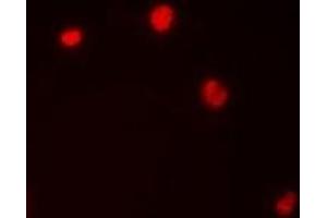 Immunofluorescent analysis of Importin alpha 1 staining in HepG2 cells.