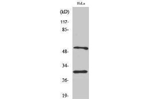 Western Blotting (WB) image for anti-Caspase 10 B/C (C-Term) antibody (ABIN3180524) (Caspase 10 B/C (C-Term) anticorps)