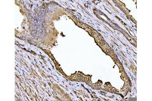 IHC analysis of Alpha Actinin 4 using anti-Alpha Actinin 4 antibody (ABIN4886421). (alpha Actinin 4 anticorps  (AA 561-661))