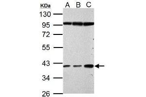 WB Image Haptoglobin antibody detects Haptoglobin protein by Western blot analysis.