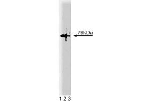 Western blot analysis of PKCtheta on a Jurkat lysate. (PKC theta anticorps  (AA 21-217))