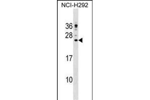 CP Antibody (C-term) (ABIN1536685 and ABIN2848635) western blot analysis in NCI- cell line lysates (35 μg/lane).