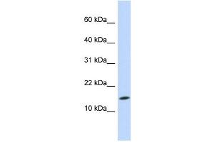 UBE2D3 antibody used at 1 ug/ml to detect target protein.