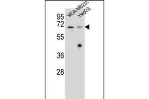 GLMN Antibody (C-term) (ABIN655986 and ABIN2845370) western blot analysis in MDA-M,HepG2 cell line lysates (35 μg/lane). (GLMN anticorps  (C-Term))