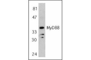 Western blot analysis of MyD88 in Jurkat whole cell lysate with this product at 1 μg/ml. (MYD88 anticorps  (AA 233-248))