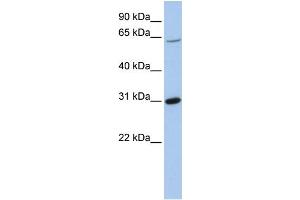 WB Suggested Anti-FRK  Antibody Titration: 0. (FRK anticorps  (Middle Region))