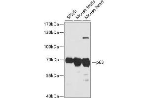 Western blot analysis of extracts of various cell lines, using p63 antibody (ABIN6133472, ABIN6149425, ABIN6149428 and ABIN6216786) at 1:3000 dilution. (p63 anticorps  (AA 1-160))