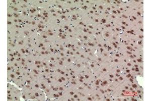 Immunohistochemistry (IHC) analysis of paraffin-embedded Rat Brain, antibody was diluted at 1:100.