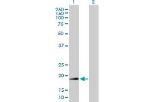 Western Blot analysis of RNF185 expression in transfected 293T cell line by RNF185 MaxPab polyclonal antibody. (RNF185 anticorps  (AA 1-192))