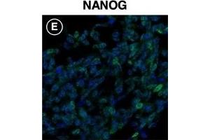 Stem cell and receptor markers expressed in iPS87 cells.