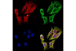 ABIN6256952 and ABIN6274638 staining Hela cells by IF/ICC.