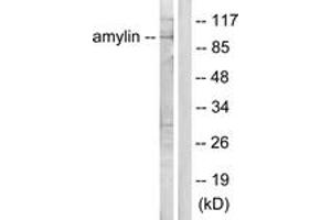 Western blot analysis of extracts from HeLa cells, treated with EGF 200ng/ml 30', using Amylin Antibody. (Amylin/DAP anticorps  (AA 1-50))
