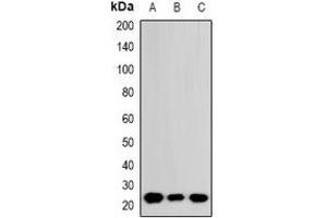 Western blot analysis of RhoGDI alpha expression in A549 (A), DLD (B), HepG2 (C) whole cell lysates. (ARHGDIA anticorps  (C-Term))