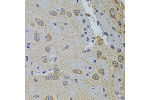 Immunohistochemistry of paraffin-embedded mouse brain using GM13125 antibody (ABIN6127294, ABIN6141172, ABIN6141175 and ABIN6216319) at dilution of 1:100 (40x lens). (Pramel15 anticorps  (AA 1-477))