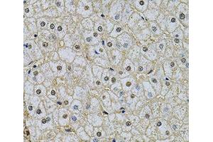 Immunohistochemistry of paraffin-embedded Human liver damage using NRF1 Polyclonal Antibody at dilution of 1:100 (40x lens). (NRF1 anticorps)