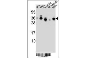 Western blot analysis in CEM,K562,NCI-H292,MDA-MB453,A549 cell line lysates (35ug/lane). (SSX4 anticorps  (AA 63-91))