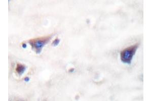 Immunohistochemistry analyzes of KSR antibody in paraffin-embedded human brain tissue. (KSR1 anticorps)