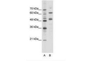 Image no. 1 for anti-GATA Binding Protein 4 (GATA4) (N-Term) antibody (ABIN6736111)