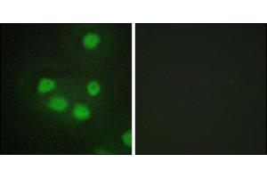 Immunofluorescence analysis of HepG2 cells, using SIX6 antibody. (SIX Homeobox 6 anticorps)