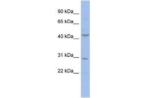 WB Suggested Anti-CCNE2  Antibody Titration: 0.