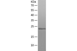 Western Blotting (WB) image for ADP-Ribosylation Factor 6 (ARF6) (AA 1-175) protein (His tag) (ABIN7121735)